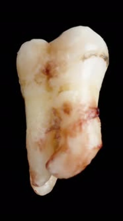 Rotating Close Up of a Single Tooth