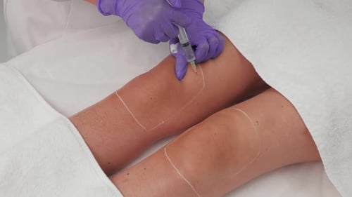 Fat Removal on Legs