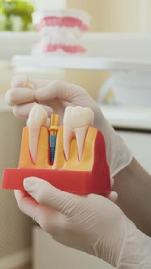 Dental Professional Demonstrating Tooth Implant Model