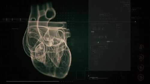 Biotech X-ray scan of human heart
