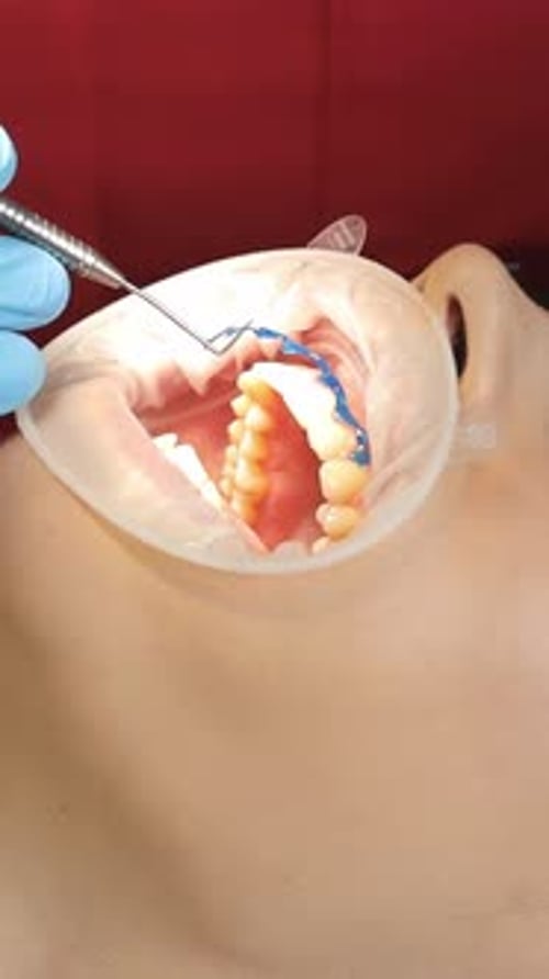 A Closeup of a Dentist Using Medical Equipment Works with a Patient in the Dental Office Vertical