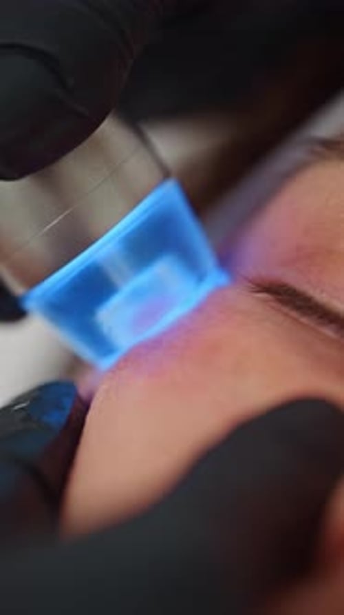 Woman Receives Facial Treatment with Blue Light Device