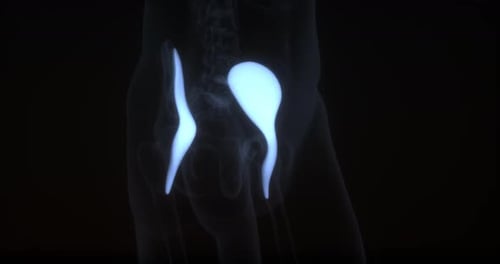 3D Human Bladder and Ureter Anatomy Medical Animation