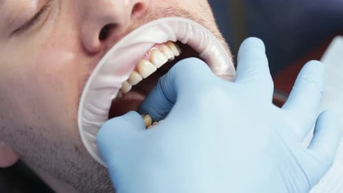 Dental Procedure Close Up Shot