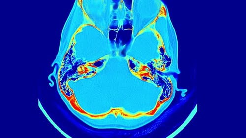 Detailed MRI Scan of the Human Brain Highlighting Anatomical Structures and Brain Tissue in Vibrant