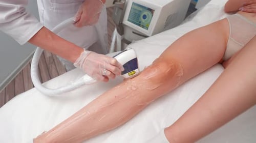 Laser Hair Removal Treatment on Woman's Leg