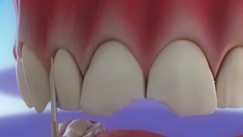 Modelo de dentadura con dientes superiores e inferiores sobre fondo morado