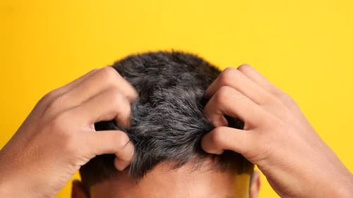 Close up Man Scratching Itchy Scalp