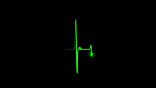 Electrocardiogram show heart beat line. Cardiogram, Heart pulse