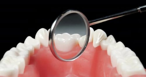 Patient at a Dentist Appointment in a Dental Clinic. View from Inside the Dental Jaw. Tooth Model