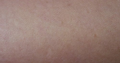 Macro Shot of Human Skin Texture