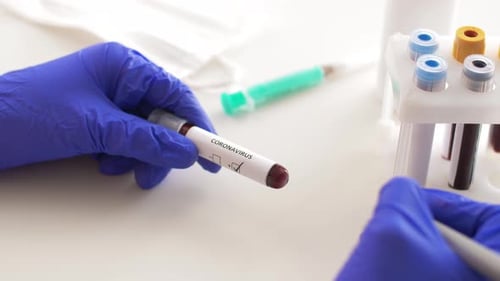 Coronavirus Check Mark Medical Concept