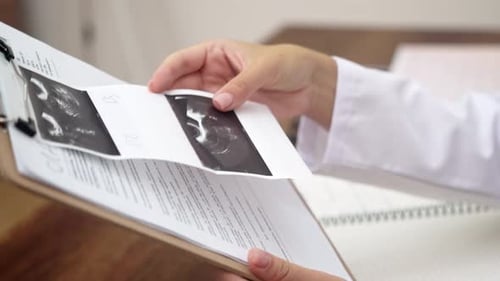 Medical Professional Reviews Ultrasound Report in Hospital