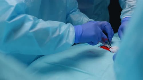 Team of Professional Medical Surgeons Performs the Surgical Operation in a Modern Hospital Doctors