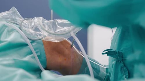 Professional Surgeon Performing Arthroscopic Knee Surgery - close up side view