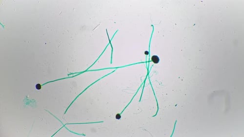 Whole Mount of Aspergillus Filmed Under Microscope Against Bright Field with 40 Magnification