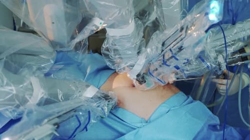 Robotic Surgery Performed in Operating Room