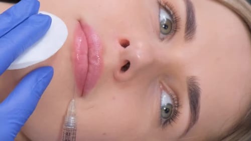 Lip Injection Procedure Close-Up: Beauty and Medical Themes