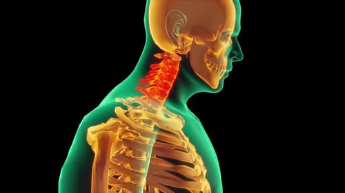 Animated 3D Model of Human Neck Vertebrae Highlighting Pain