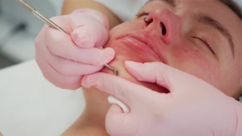 Cosmetology Clinic Professional Female Cosmetologist Doing Deep Pore Cleansing Using Specialized