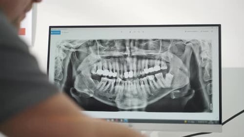 Panoramic Xray of Jaws on Screen Male Dentist Shows Xray of Jaws on Computer Screen to Female