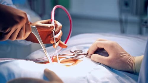 Surgical Operation Performed with Instruments in Operating Room