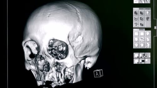 Detailed 3D medical scan of human skull