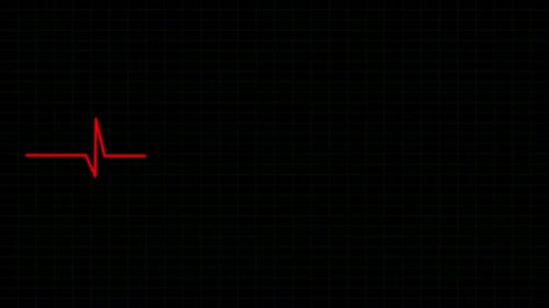 Heart Rate Monitoring Display