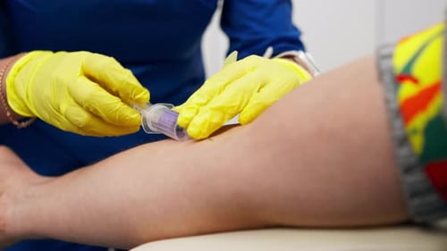 Close Up in the Clinic a Guy Asks a Doctor with a Blue Form for Blood Tests Healthy Lifestyle