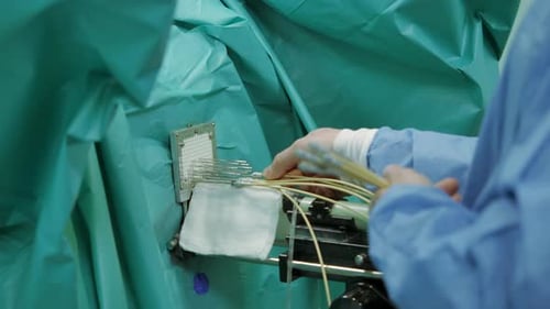 Close Up of Medical Procedure at the Hospital with Special Equipment