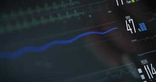 Medical Monitor Displaying Vital Signs with Stylus