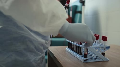 Mediziner sammelt Reagenzgläser mit Blut