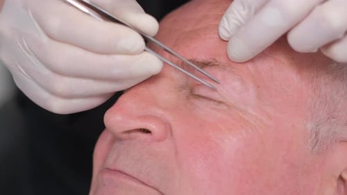 Closeup Preparation for Plastic Surgery on the Face of an Elderly Man