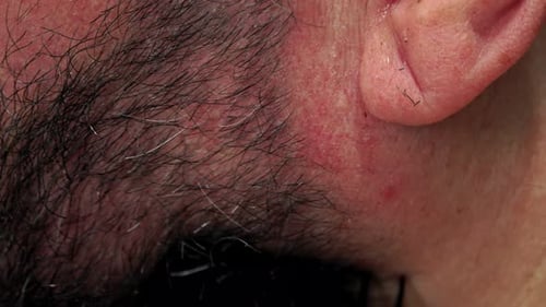 Electric Trimmer Trims Facial Hair, Macro Close-Up