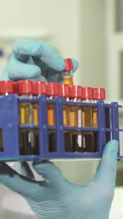 Handling Test Tubes in Lab with Medical Gloves