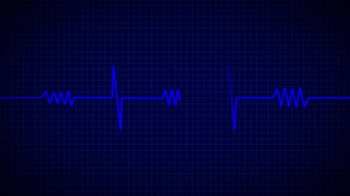 Animated Heartbeat ECG Line on Blue Grid Background