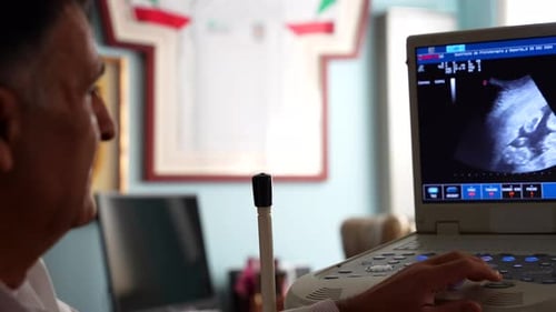 Séance d'échographie montrant la forme et la colonne vertébrale du bébé, gynécologue flou au premier plan