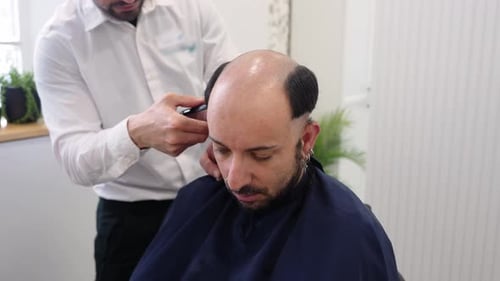 Hair Clinic Technician Preparing Patient for Hair Implant Surgery
