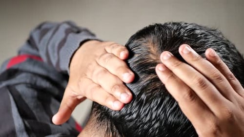 Close Up of Man Checking Thinning Hair