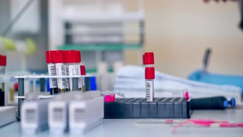 Lab with Vials and Scientific Experimentation