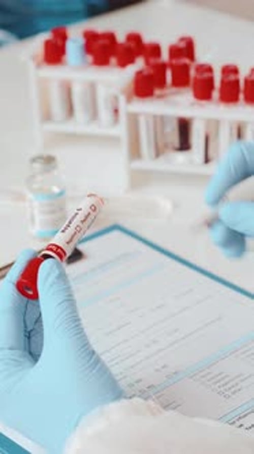 Scientist Examines Hepatitis D Positive Sample in Lab