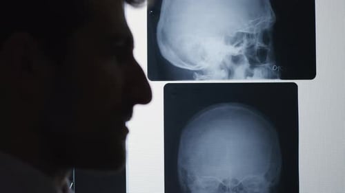 Doctor Reviewing Skull Xrays in Medical Office