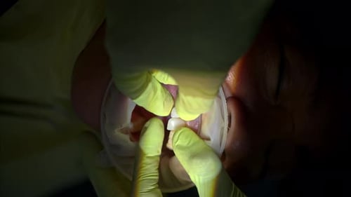 Slow motion vertical shot of a dentist pair of hands with green gloves taking off a patients veneer