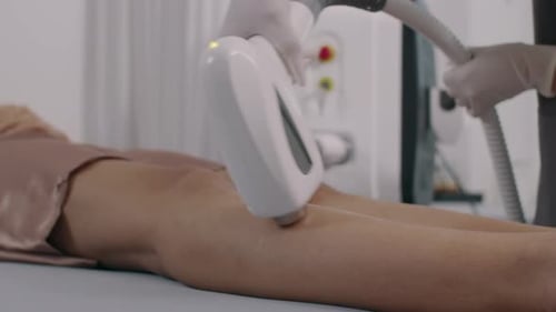Laser Hair Removal Treatment on Woman's Legs