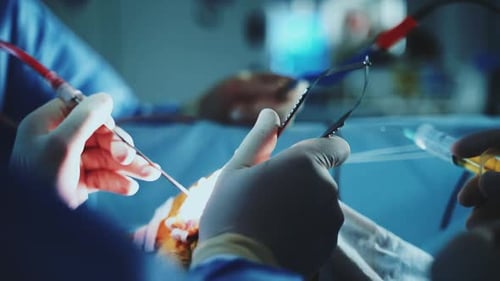 Surgeons Performing Surgery with Surgical Instruments