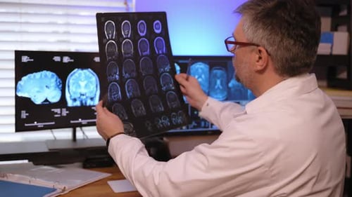 The Doctor is Analyzing a Patient MRI Scan in a Medical Hospital to Diagnose Brain Conditions and