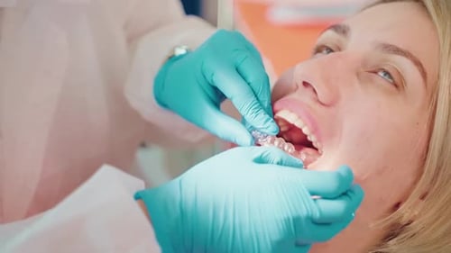 Stomatologist Installing Clear Aligners on Teeth of Adult Woman Technology for Adjusting Teeth