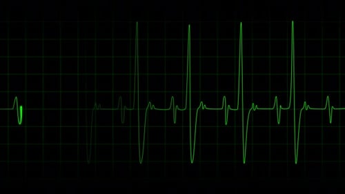 Digital Heartbeat Monitor ECG Waveform Animation