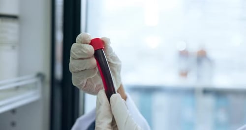 Test tube, medical or hand in clinic with blood, biology or dna investigation for pharmaceutical