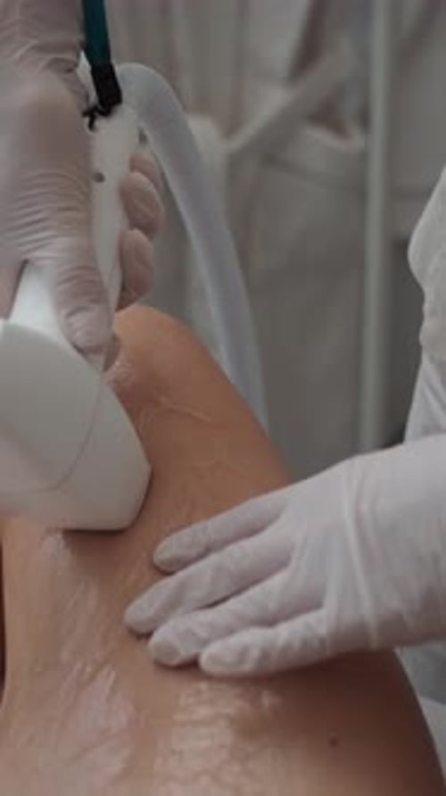 Laser Hair Removal Treatment on a Woman Legs in a Professional Clinic